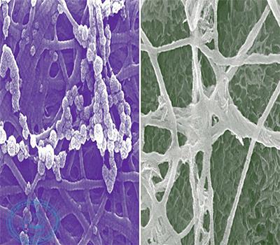 مقایسه توانایی bone regeration