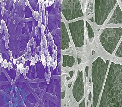 مقایسه توانایی bone regeration 